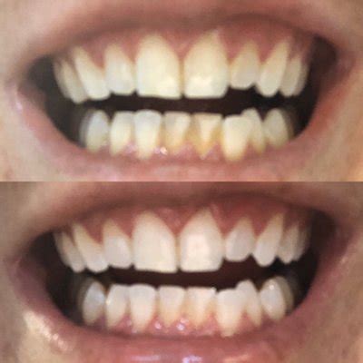 Smile Transformation 101: A Look Inside Magic Smile Midtown